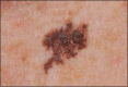 Image 1(a)