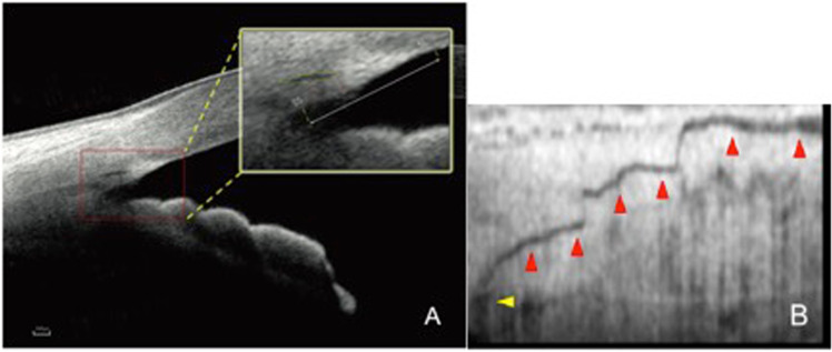 Fig. 4