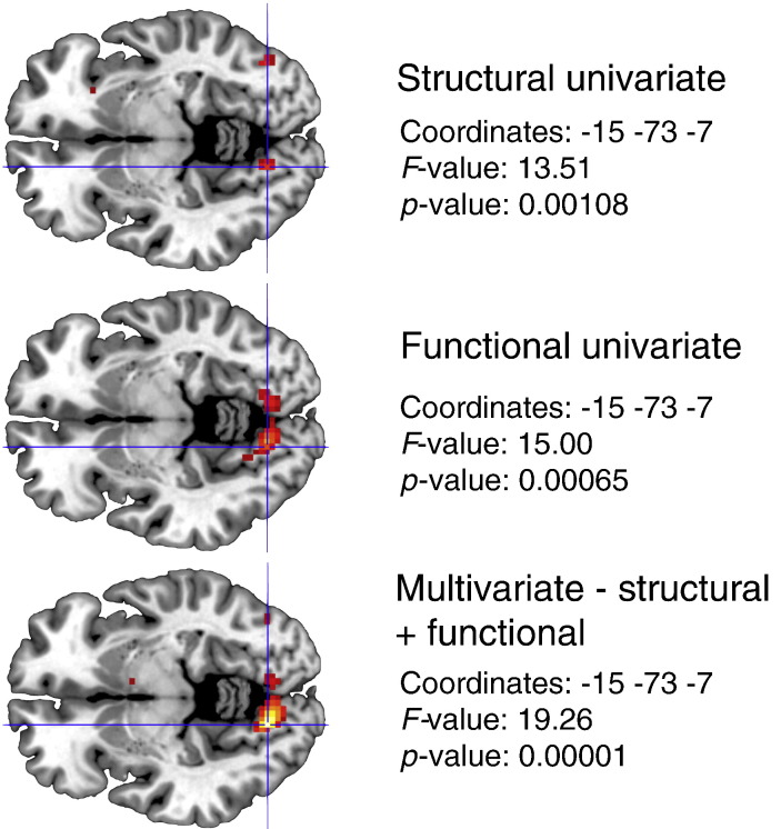 Fig. 11