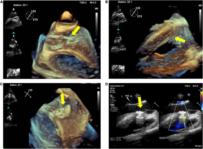 FIGURE 2