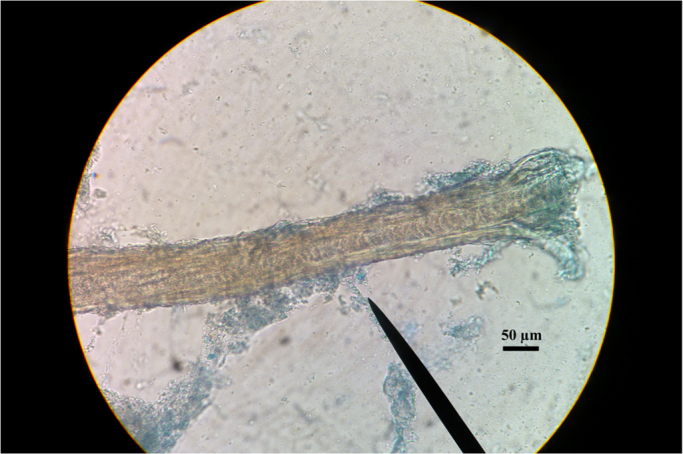 Fig. 2