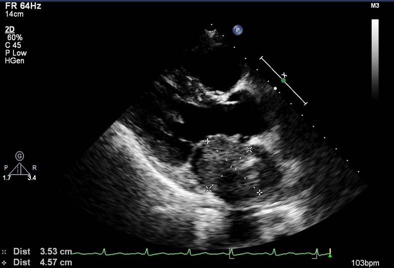 Figure 2