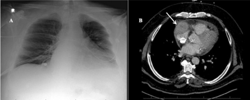 Fig. 5