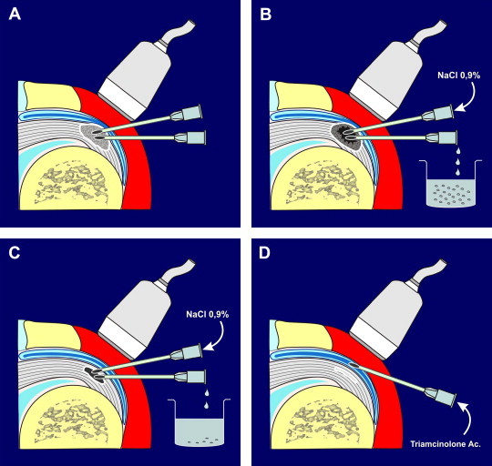 Fig. 1