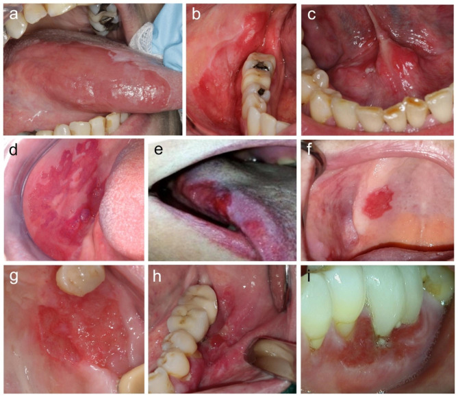 Fig. 2