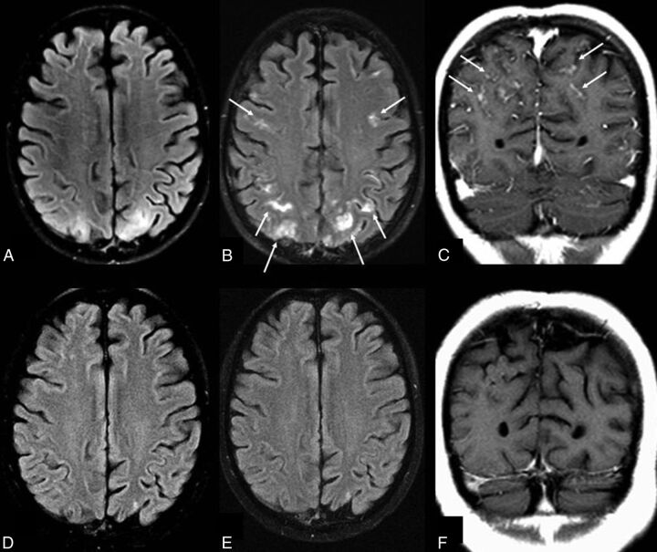 Fig 3.