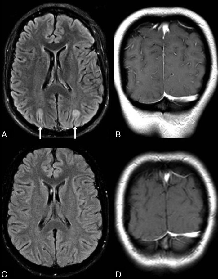 Fig 2.