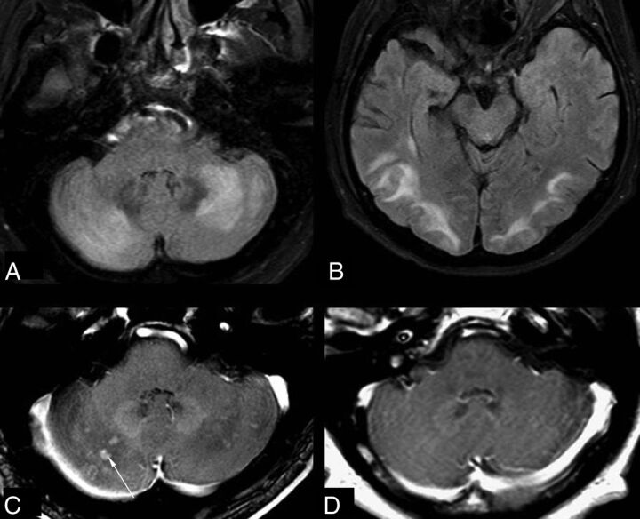 Fig 4.