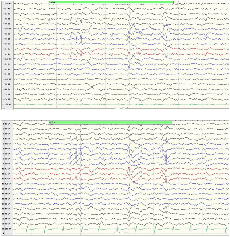 Figure 2