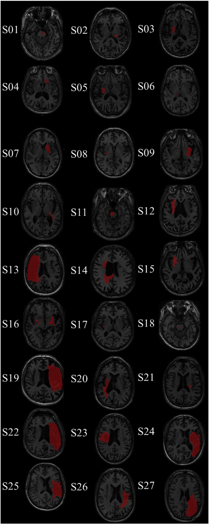 Fig. 1