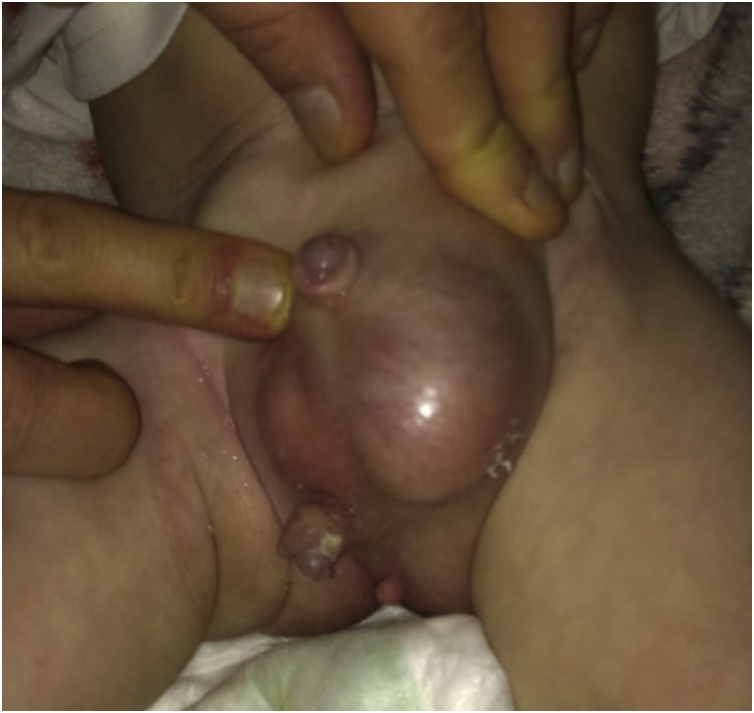 Fig. 1