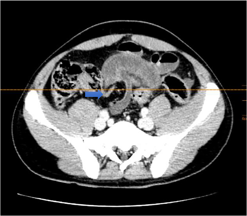 Fig. 3