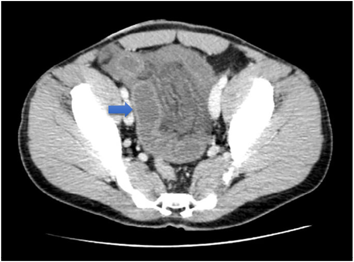 Fig. 2