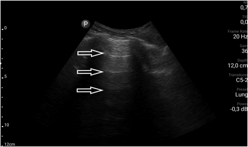 Fig. 5a