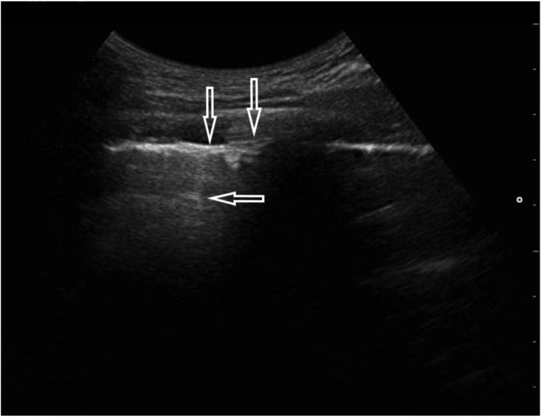 Fig. 3a