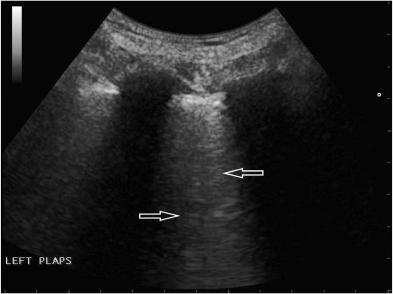 Fig. 4a