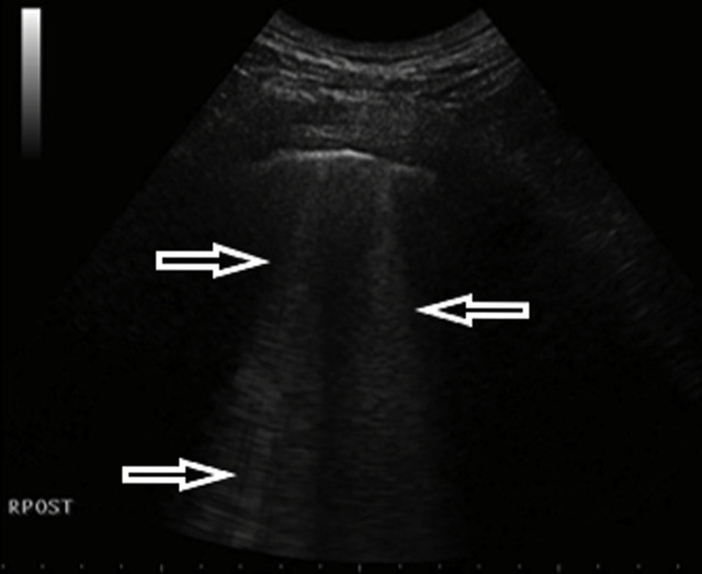 Fig. 6a