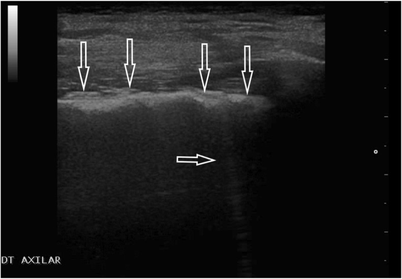 Fig. 4b