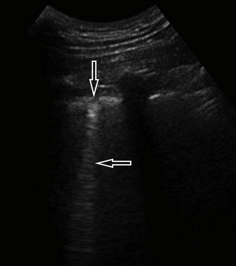 Fig. 6b