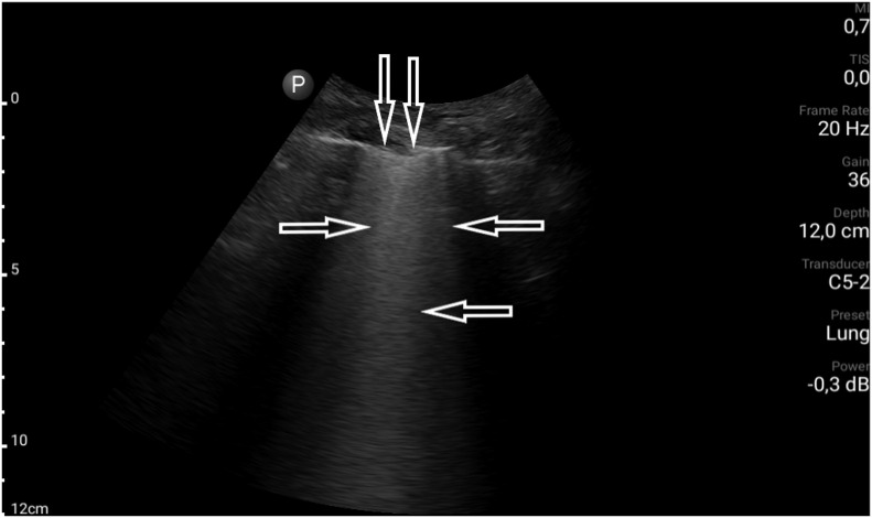 Fig. 5b