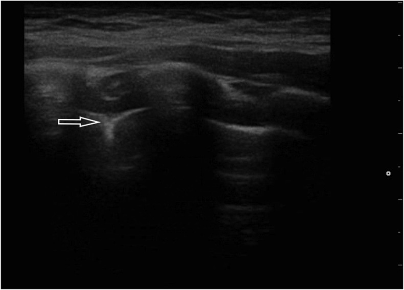 Fig. 3b