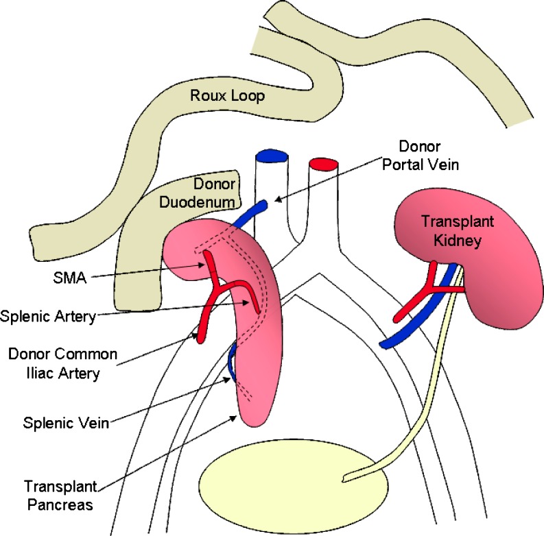 Fig. 1