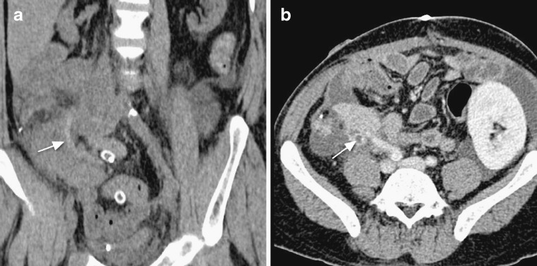 Fig. 6