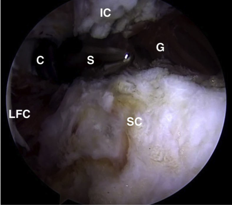 Fig 20