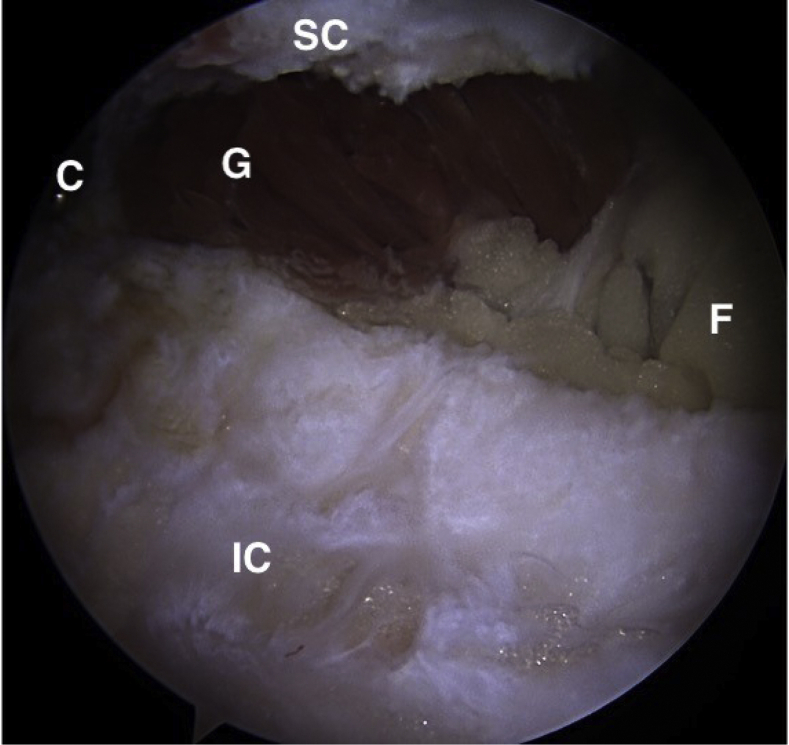 Fig 21