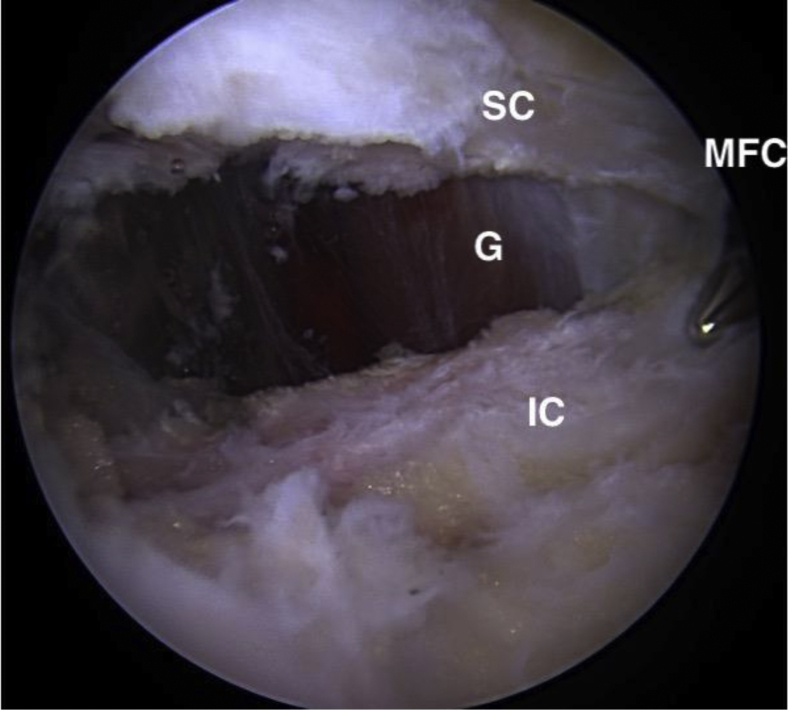 Fig 14