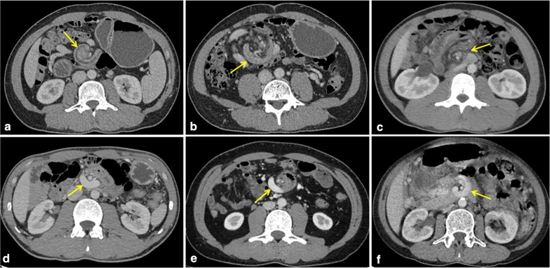 Fig. 4