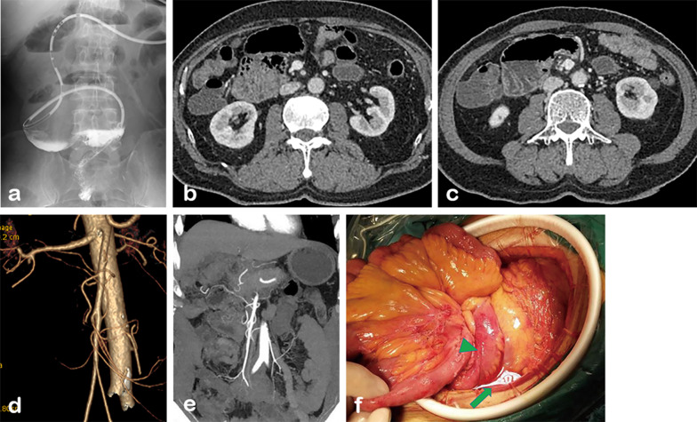 Fig. 6