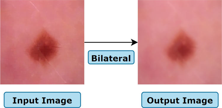 Fig 17