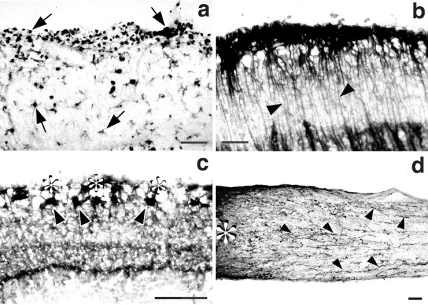 Fig. 11.