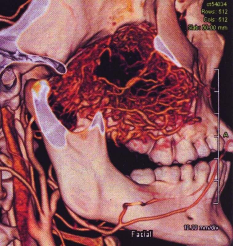 Fig. 13