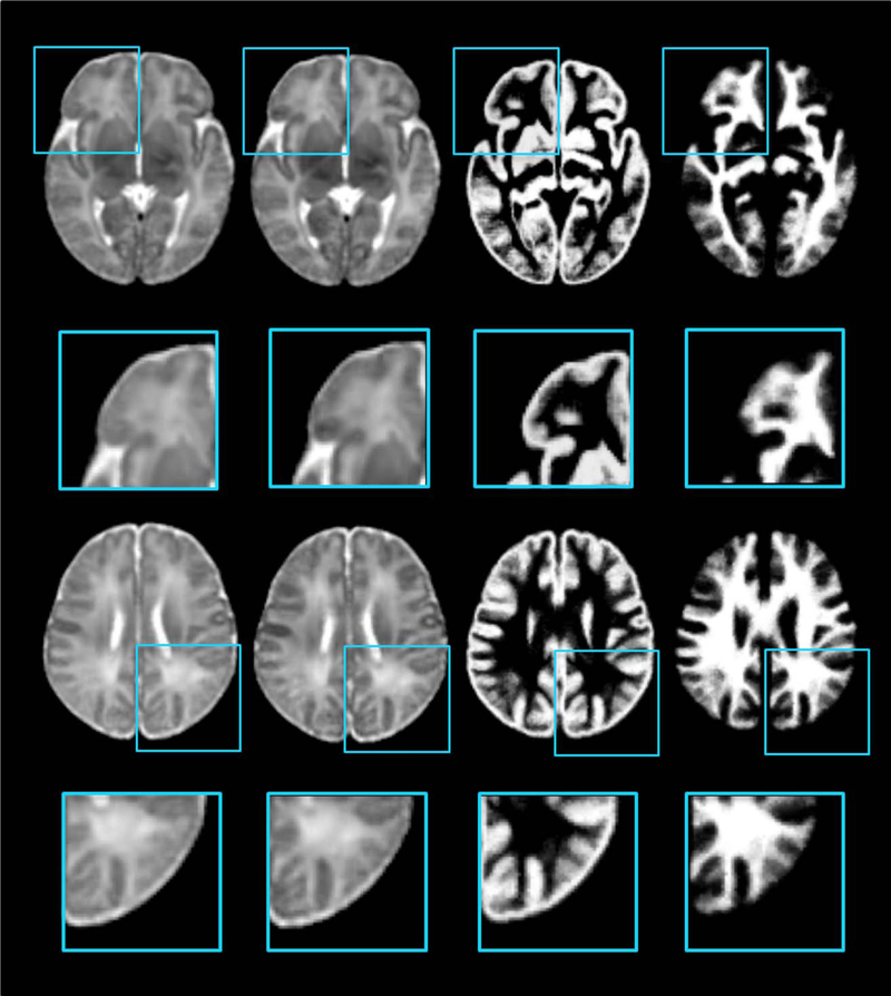 Figure 12.