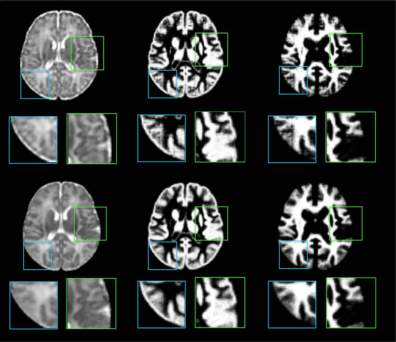 Figure 11.