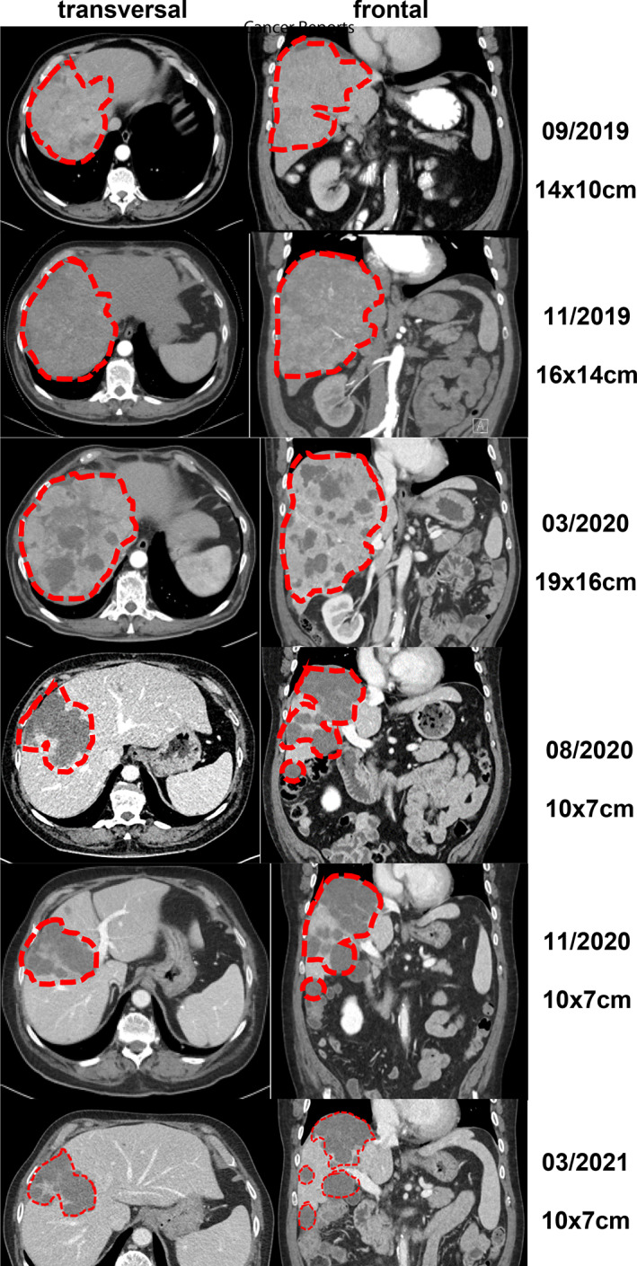 FIGURE 4