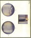 170-1