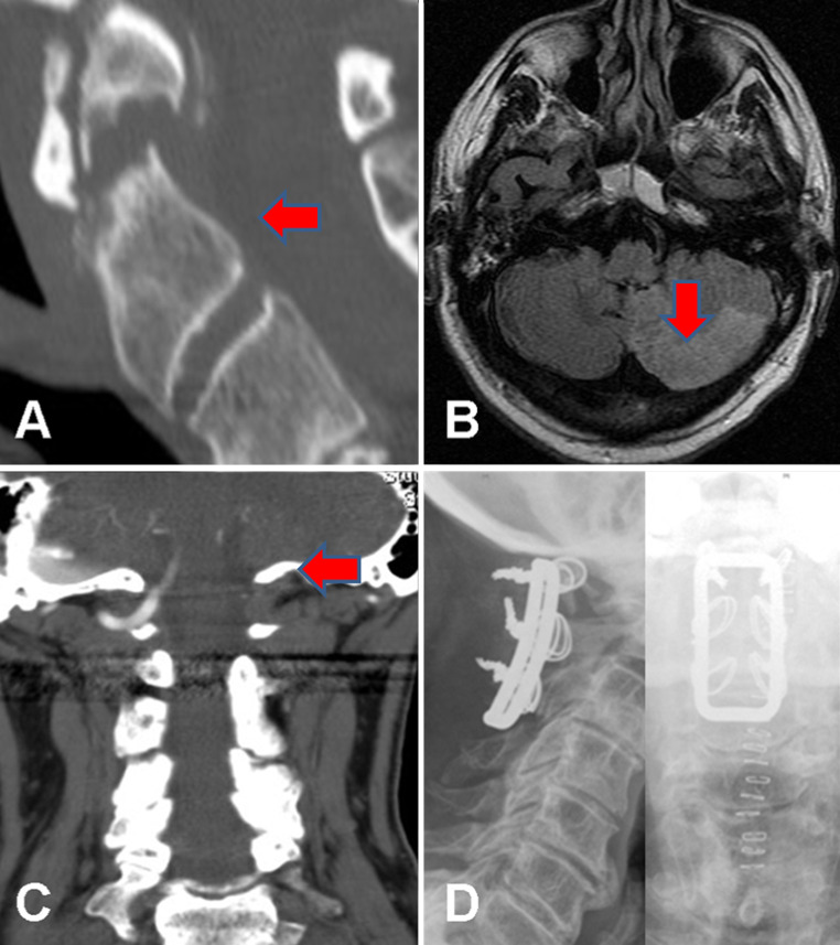 Fig. 2