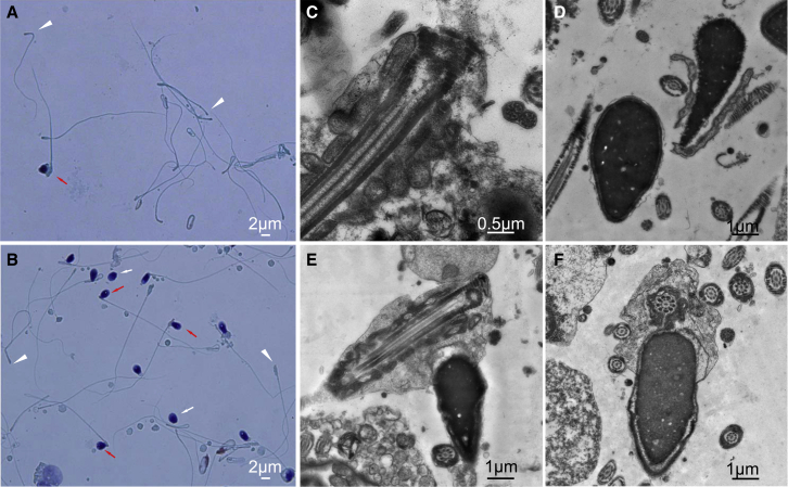 Figure 1