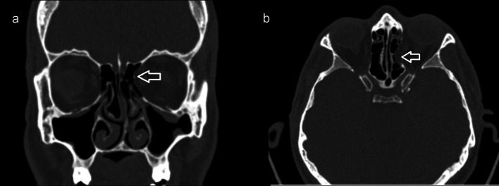 Fig. 1