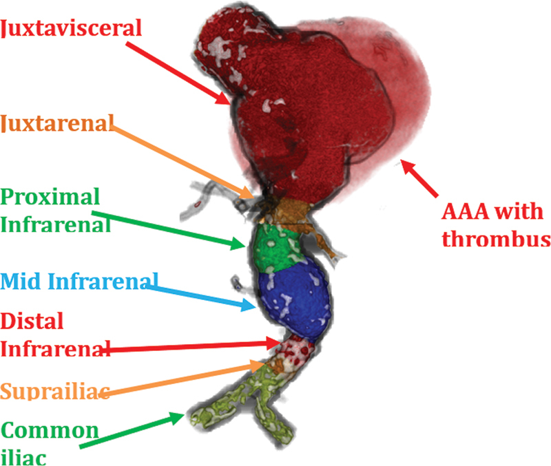 Fig. 11