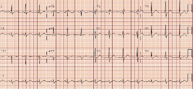 Figure 2