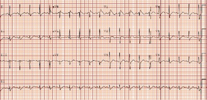 Figure 1