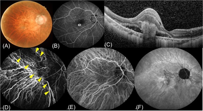 Fig. 2