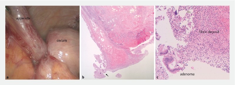 Fig. 2