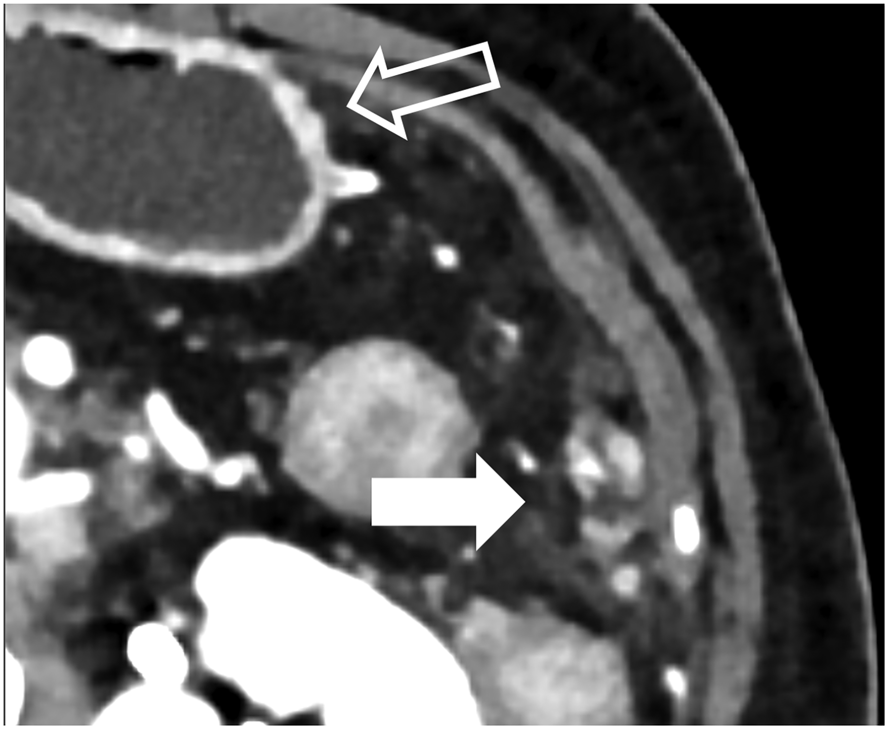 Figure 4: