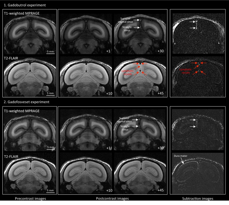 Figure 2—figure supplement 1.