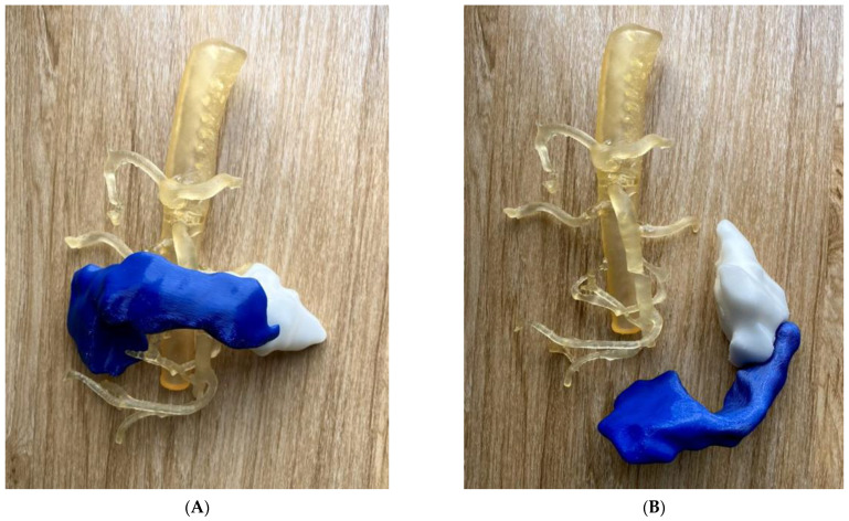 Figure 20